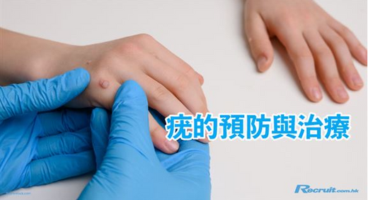 Recruit 報導 - 疣的成因與預防措施